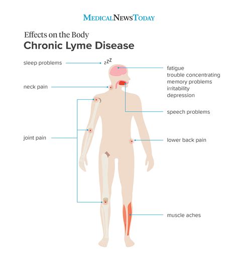 Lyme Disease Symptoms Progression And When To See A Doctor