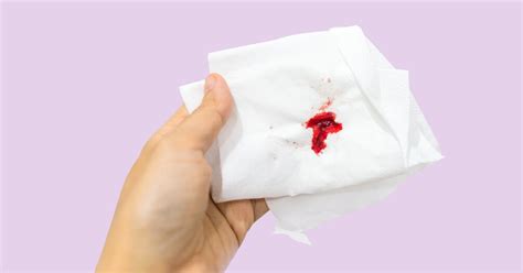8 Reasons You May Be Bleeding After Sex World Socio