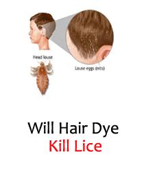 hair dye kill lice