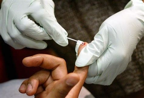hiv cases rise due to paid sex