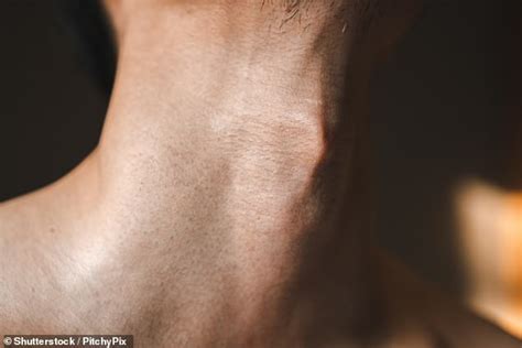 sexist body terms like adam s apple should no longer be used doctor