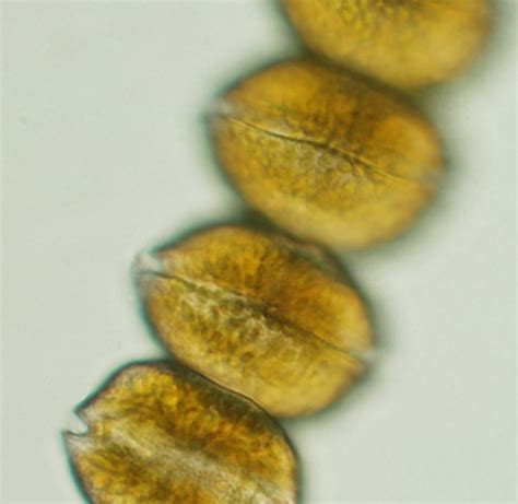 alexandrium monilatum light micrograph alexandrium monil flickr