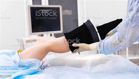 leg of patient in a stocking from varicose veins in the hospital stock