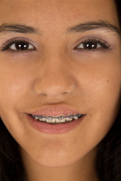Cute Hispanic Teen Girl Wearing Braces On Her Teeth