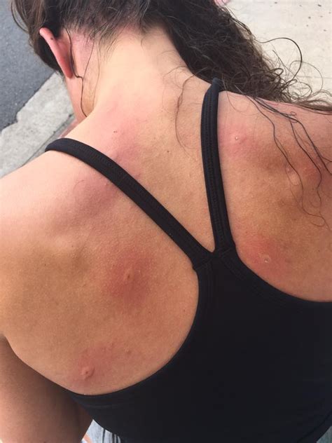 Woman Goes For A Jog Thousands Of Angry Bees Swarm And Sting Her