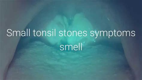 clean  tonsil stones  gagging youtube