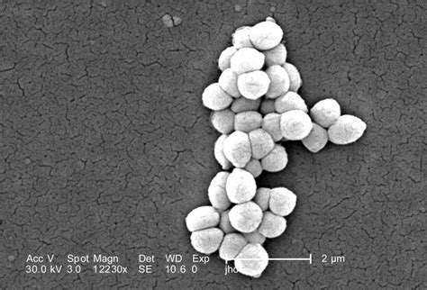 Free Picture Scanning Electron Micrograph Gram Positive