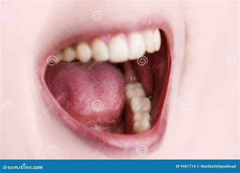 open mouth  teeth stock images image