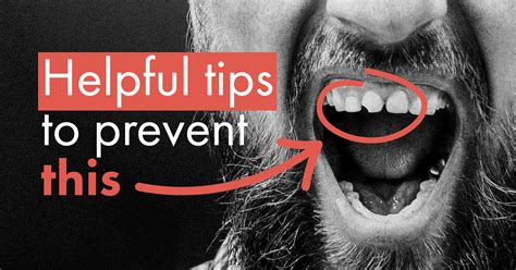 common ways people chip  teeth lynnfield dental associates blog