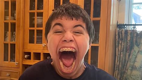 Midwest Teen Breaks The Record For Largest Mouth Gape [watch]