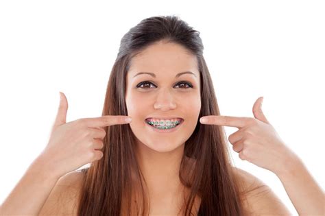 Foods To Eat After Getting Braces Tightened Bracify 3d Orthodontics