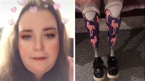 Mom Loses Both Legs During C Section And Trolls Say She Should Ve Kept