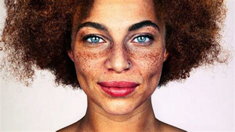 freckles photographer shines spotlight on the beauty of spots