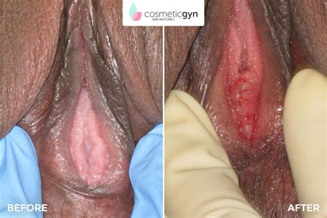 vagina hymen collage porn video