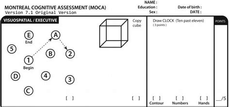 view  version   printable moca test cheesengsy