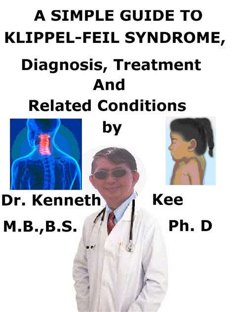 A Simple Guide To Klippel Feil Syndrome Diagnosis Treatment And