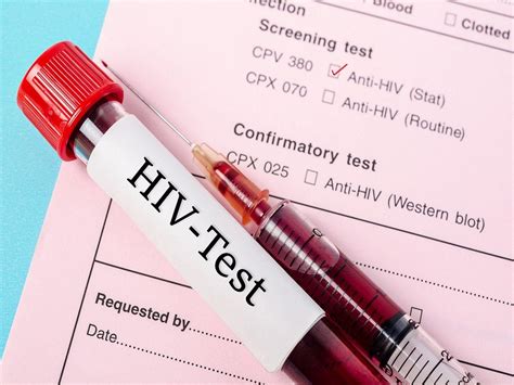 hiv infection    current testing methods  hivaids   importance  hiv