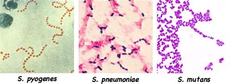 Streptococcus Pneumoniae Cocci In Pairs Gram