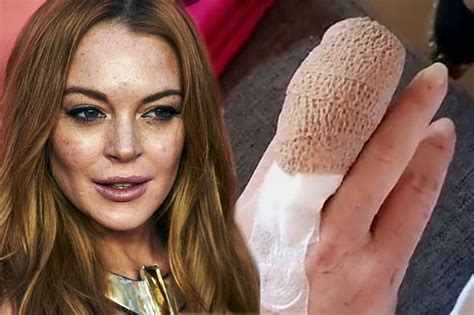 Lindsay Lohan Has Surgery To Reattach Half Her Finger After Gruesome