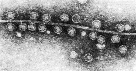 enterobacteria phage qbeta wikipedia