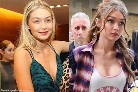 does gigi hadid have cosmetic surgery before and after 2018