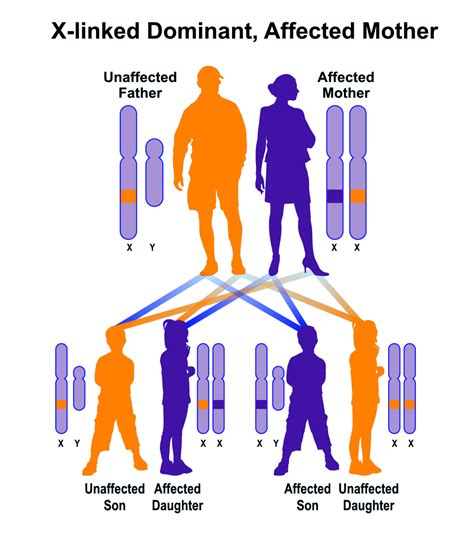 fabry disease hereditary ocular diseases