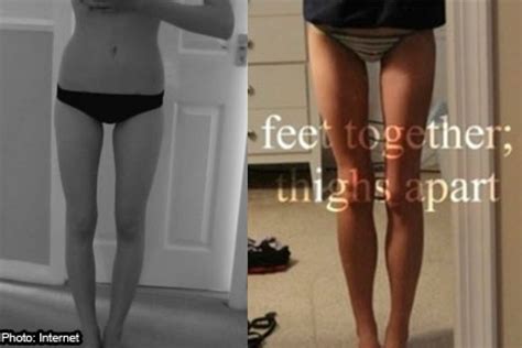 Us Teens Dangerous Obsession With Thigh Gap World News Asiaone