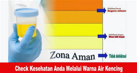 Warna Air Kencing Yang Normal Dan Sehat