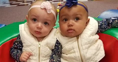 These Adorable Twins Were Born With Two Different Skin