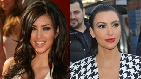 kim kardashian plastic surgery before and after nose job botox and