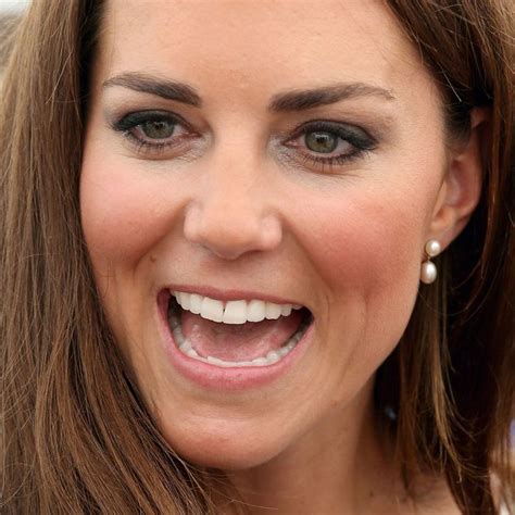 Kate Middleton’s Nose In High Demand With Plastic Surgeons
