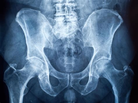 humans have no penis bone because sex doesn t last long enough scientists discover the