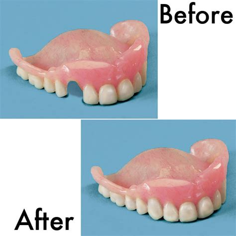 Denture Repair Kit Denture Repair Kit With Teeth Walter Drake