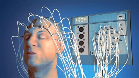 is electroconvulsive therapy making a comeback the