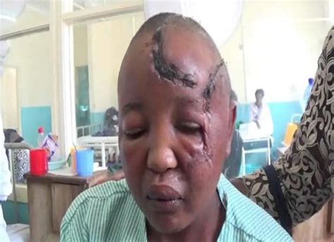 photos video man chops off wife s hands for not conceiving after seven years of marriage