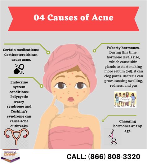 when it comes to what causes acne in centreville va it is important