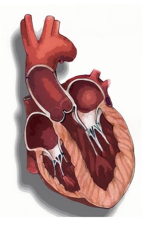 decreased cardiac output ncp heart failure