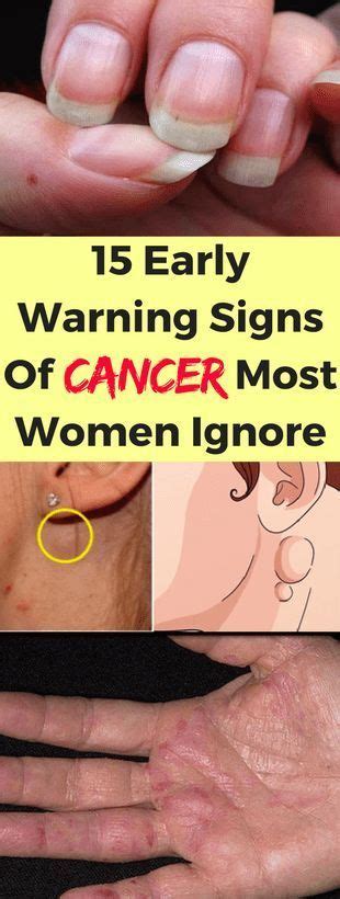 cancer symptoms women  ignore healthy lifestyle