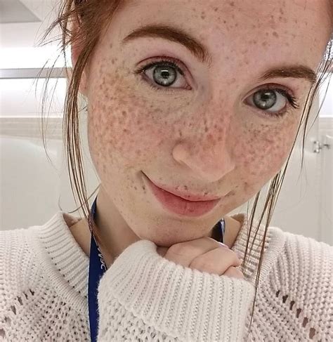 freckles freckles and freckles r prettygirls