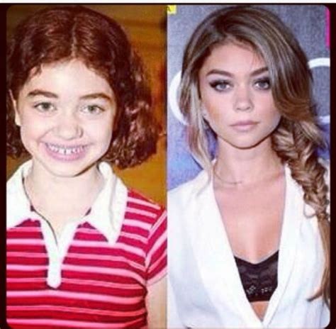 Girl Before After Puberty