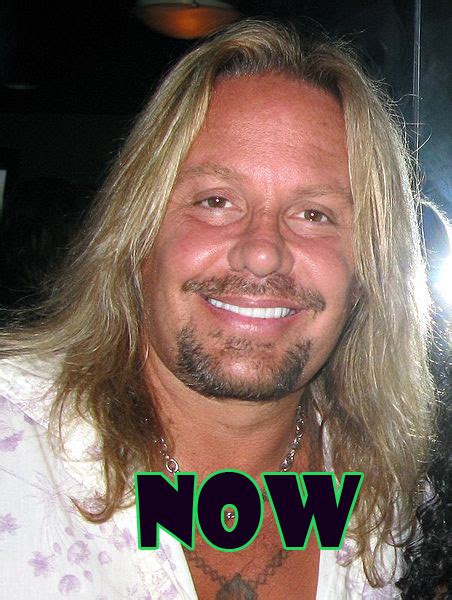 Vince Neil Plastic Surgery Before And After Brow Lift Check Lift And