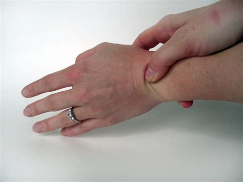 repetitive strain injury    warning signs    prevent