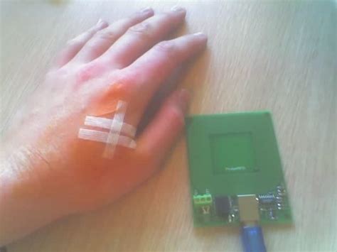 Cashless Society Microchips Under The Skin A Desirable