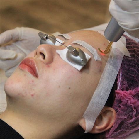 in china beauty is only skin deep in the ‘micro procedure craze