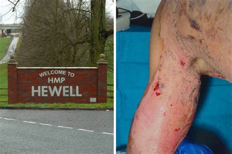 graphic content inmate suffers burns in napalm attack at brit jail daily star