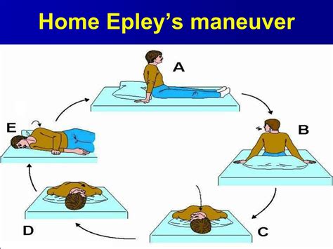 eply maneuver epley maneuver  telemed  home epley maneuver