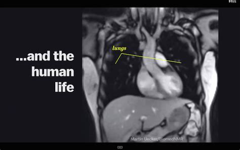 Mri View Of What Really Goes On Inside Your Body When You Re Having Sex