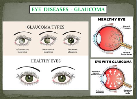 eye problems signs symptoms  natural treatment smooth natural