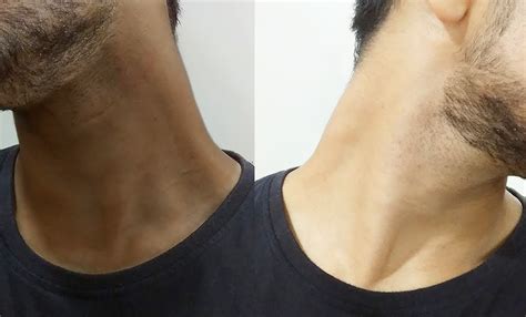 ashamed   grime   neck  tips  benefit