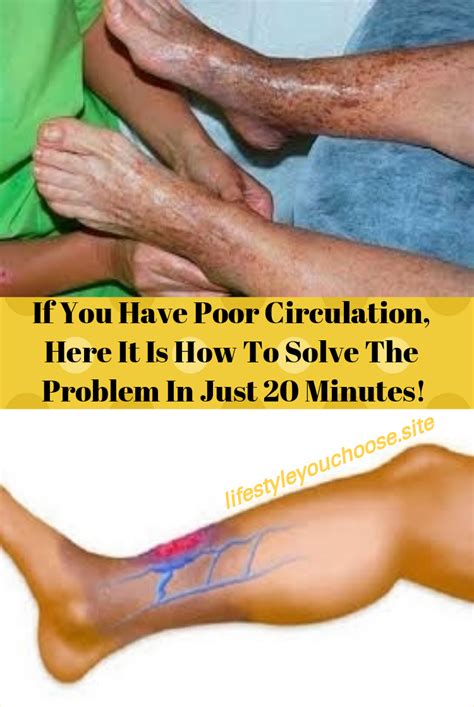 poor circulation      solve  problem